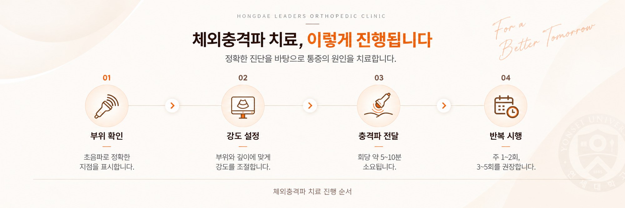체외충격파 치료 진행 순서 — 부위 확인, 강도 설정, 충격파 전달, 반복 시행의 4단계