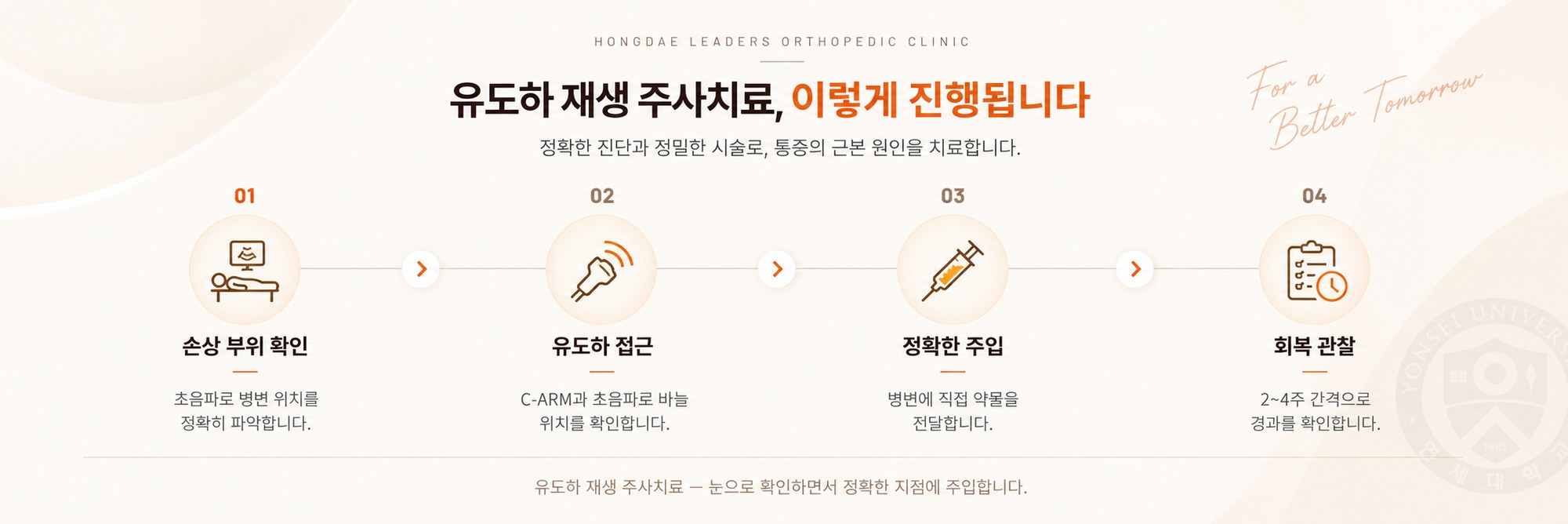 유도하 재생 주사치료 진행 순서 — 손상 부위 확인, 유도하 접근, 정확한 주입, 회복 관찰의 4단계